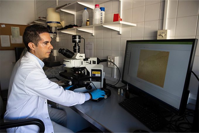 Identifican un marcador en sangre que podría ser clave en fases iniciales del alzhéimer