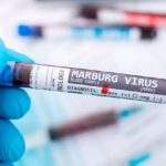 Elevan a siete los muertos por el brote de la enfermedad del virus de Marburgo en Etiopía