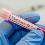 Salud Pública afirma que refuerza protocolos ante virus emergentes como el Nipah