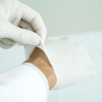 Se explotó un grano en la cara y tuvo que ser hospitalizada